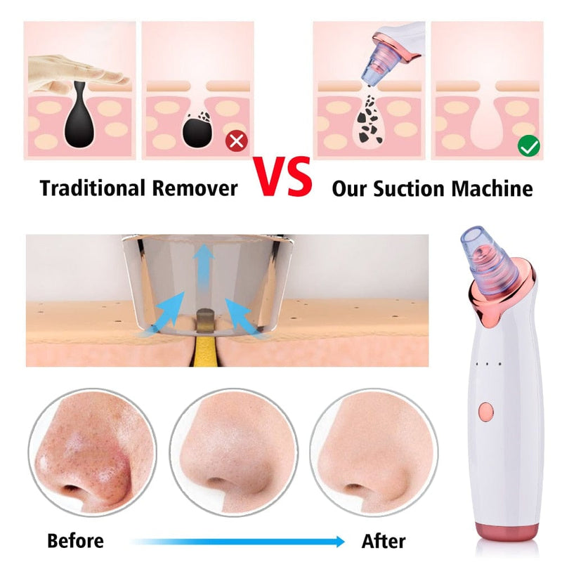 Beach Luxe Blackhead Instrument Electric Suction Facial Washing Instrument Beauty Acne Cleaning Blackhead Suction Instrument Health and Beauty